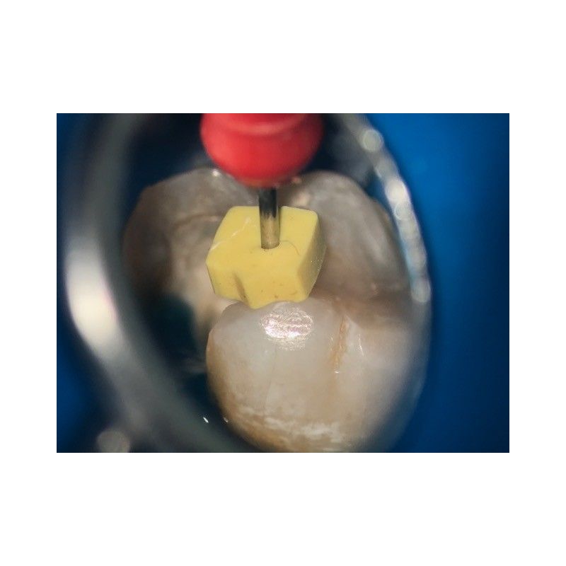 Adaptor Foto iPhone 7s