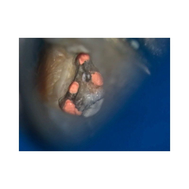 Adaptor Foto iPhone 7s