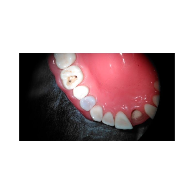 Adaptor Foto iPhone 7s