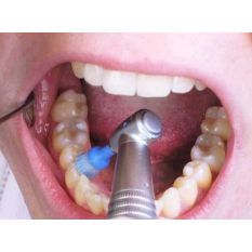 Perii polishat si curatat peri naturali