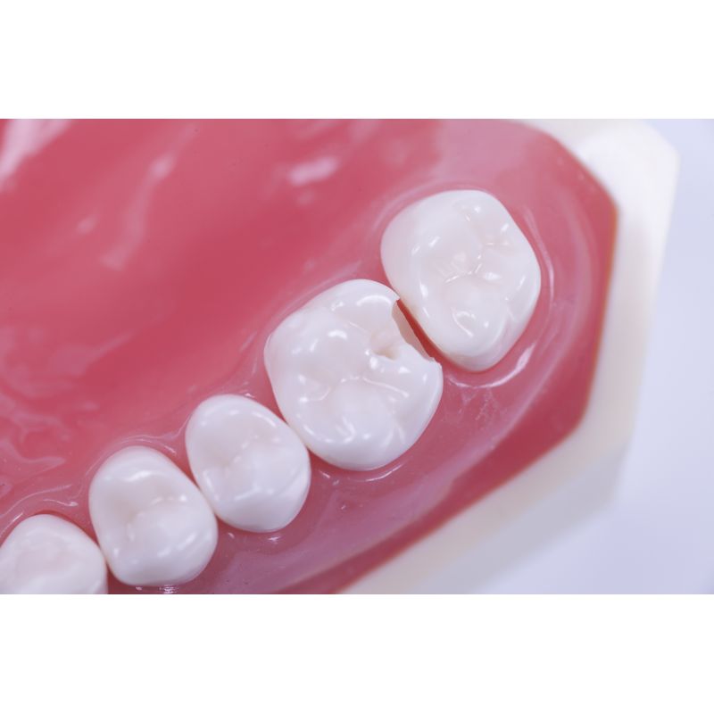 FenderMate Asortat 4 x 18 buc + organizer