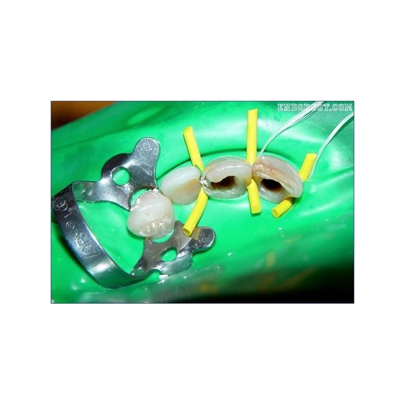 Snur Wedjets Stabilizing Cord