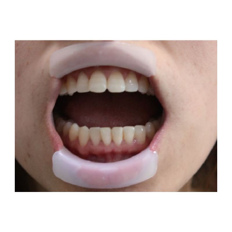 Departator bucal tip O 10 Buc