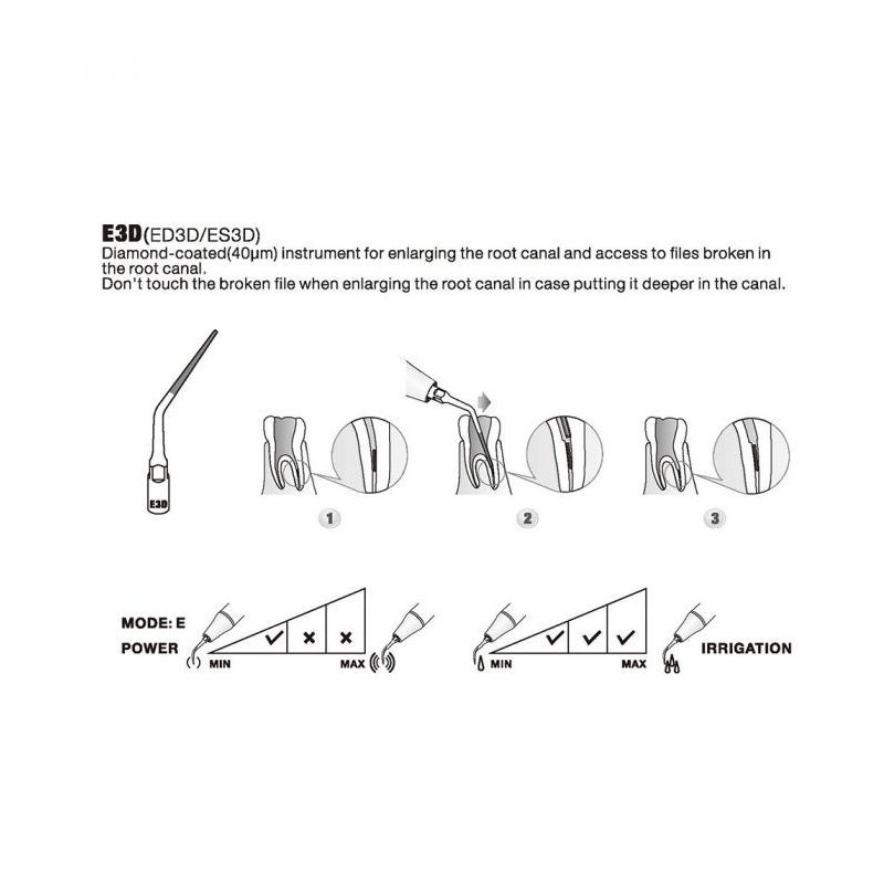 Ansa largire canal radicular E3D