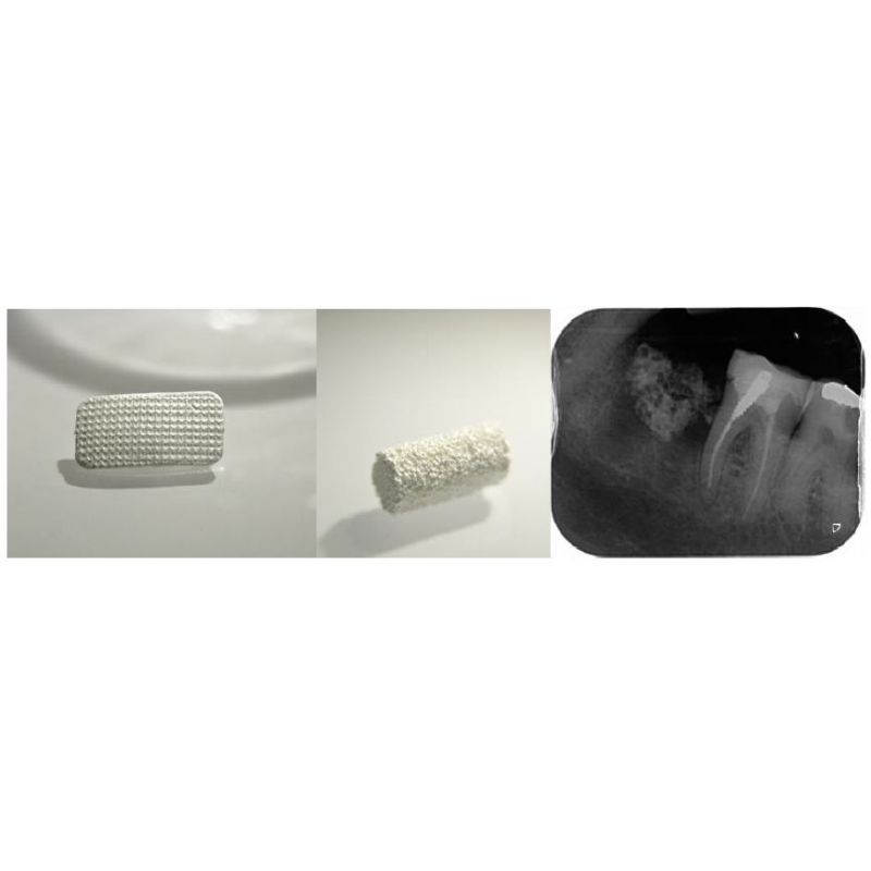 Membrana colagen SinossMem AlveolarRepair