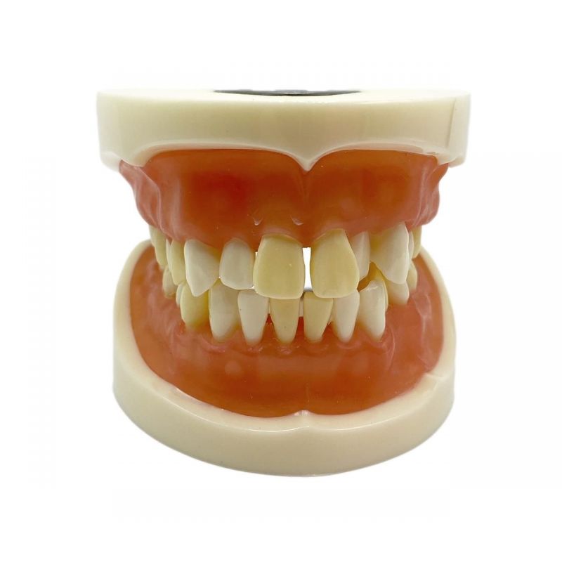 Model studiu extractie