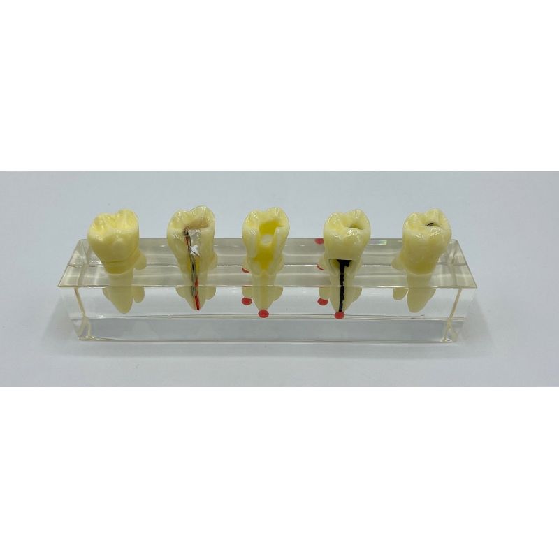 Bloc training canal radicular