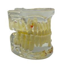 Model pediatric cu dentitie mixta si carii