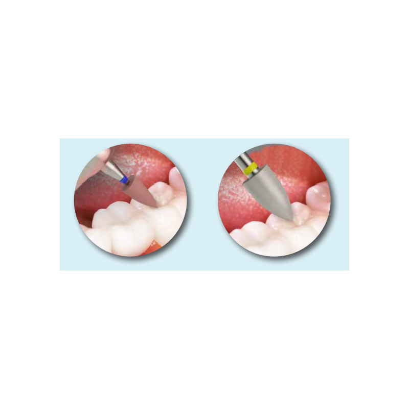 Gume Kenda All Ceramic