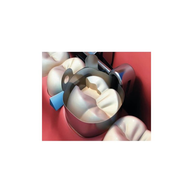 Pene interdentare din lemn 200 bucati