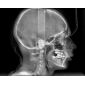 Aparat radiologie ortopantomograf OPG Stellaris 2D cu brat cefalometric (XDI-250) Aparat radiologie ortopantomograf OPG Stellaris 2D cu brat cefalometric (XDI-250)
