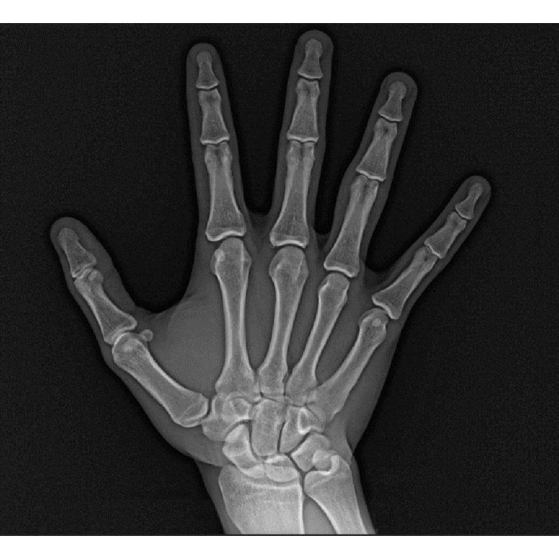 Aparat radiologie ortopantomograf OPG Stellaris 2D cu brat cefalometric (XDI-250)