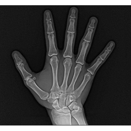 Aparat radiologie ortopantomograf OPG Stellaris 2D cu brat cefalometric (XDI-250) Aparat radiologie ortopantomograf OPG Stellaris 2D cu brat cefalometric (XDI-250)
