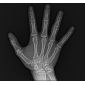 Aparat radiologie ortopantomograf OPG Stellaris 2D cu brat cefalometric (XDI-250) Aparat radiologie ortopantomograf OPG Stellaris 2D cu brat cefalometric (XDI-250)