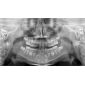 Aparat radiologie ortopantomograf OPG Stellaris 2D cu brat cefalometric (XDI-250) Aparat radiologie ortopantomograf OPG Stellaris 2D cu brat cefalometric (XDI-250)