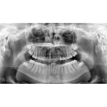 Aparat radiologie ortopantomograf OPG Stellaris 2D cu brat cefalometric (XDI-250) Aparat radiologie ortopantomograf OPG Stellaris 2D cu brat cefalometric (XDI-250)