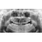 Aparat radiologie ortopantomograf OPG Stellaris 2D cu brat cefalometric (XDI-250) Aparat radiologie ortopantomograf OPG Stellaris 2D cu brat cefalometric (XDI-250)