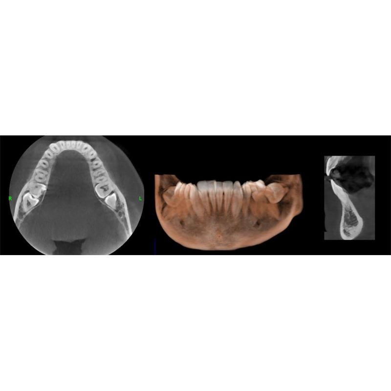 Aparat CBCT Stellaris 3D cu brat cefalometric (XDI-350)