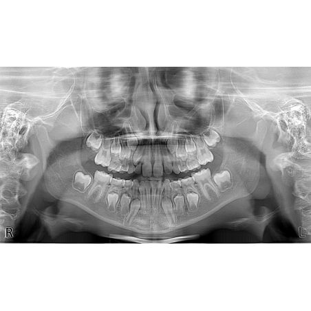 Aparat CBCT Stellaris 3D cu brat cefalometric (XDI-350)