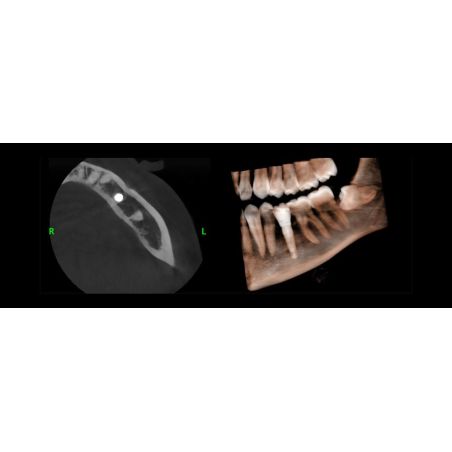 Aparat CBCT Stellaris 3D cu brat cefalometric (XDI-350)