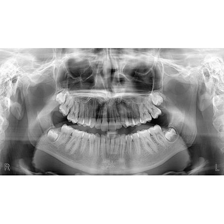 Aparat CBCT Stellaris 3D cu brat cefalometric (XDI-350)