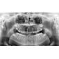 Aparat CBCT Stellaris 3D cu brat cefalometric (XDI-350) Aparat CBCT Stellaris 3D cu brat cefalometric (XDI-350)