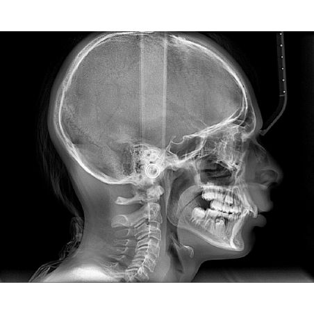 Aparat CBCT Stellaris 3D cu brat cefalometric (XDI-350)