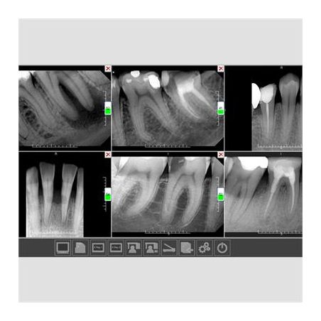 Senzor RVG StarX Pro XDI-401 marimea 1
