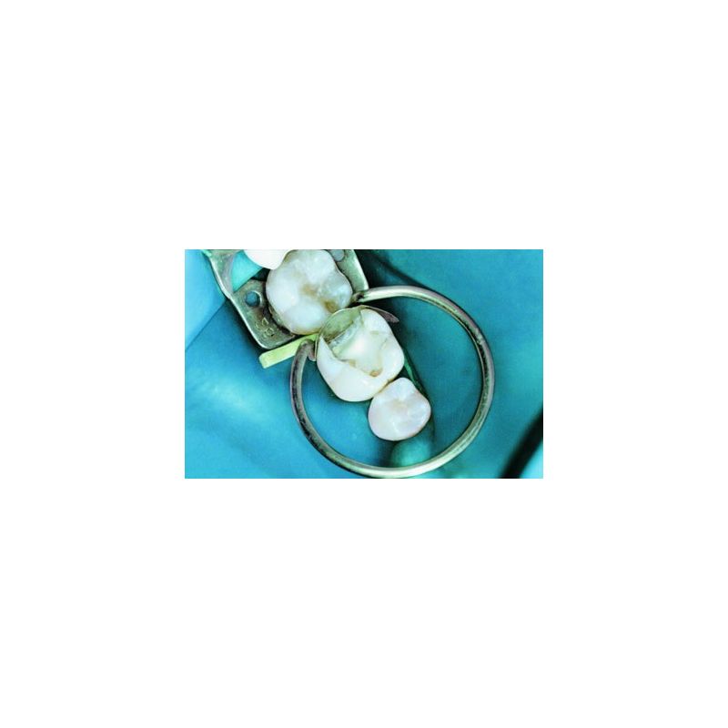 Rezerva matrice Unimatrix