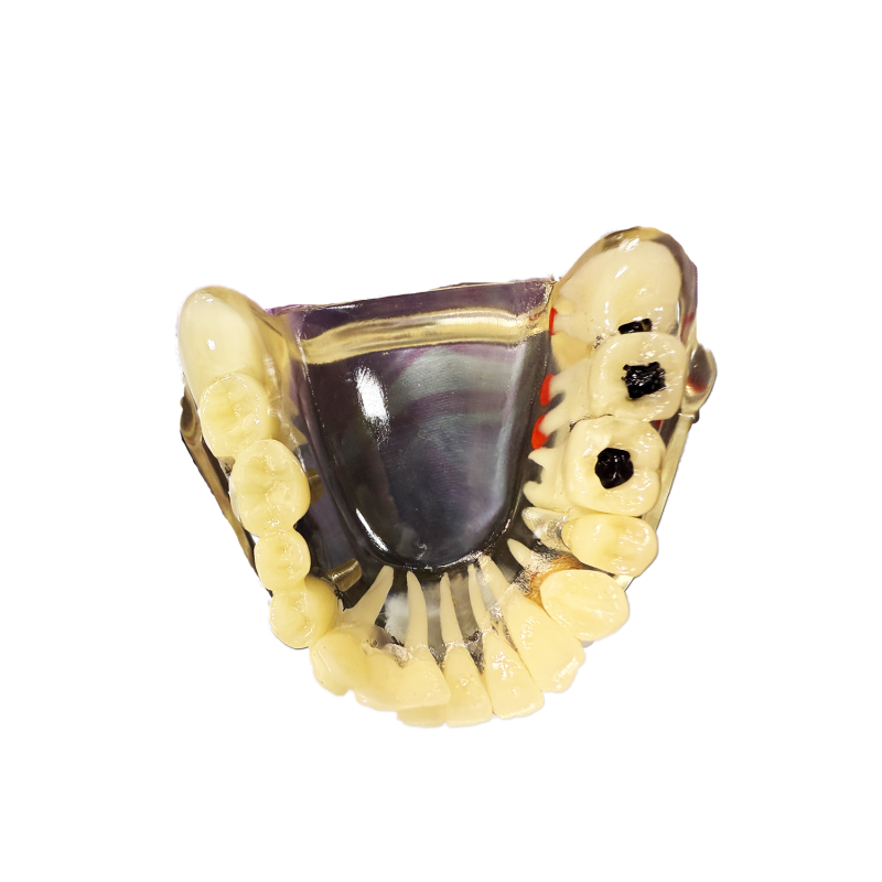 Model studiu 8 patologii dentare