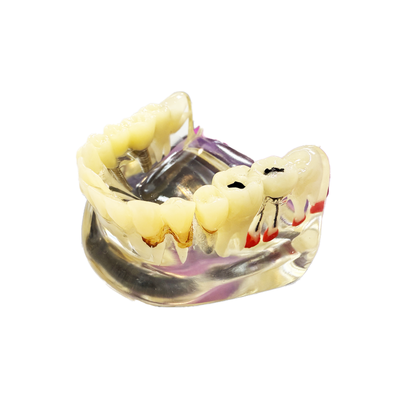 Model studiu 8 patologii dentare