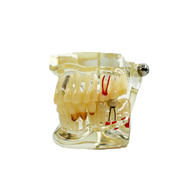 Model studiu 8 patologii dentare