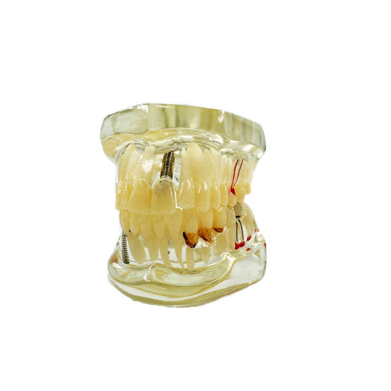 Model studiu 8 patologii dentare