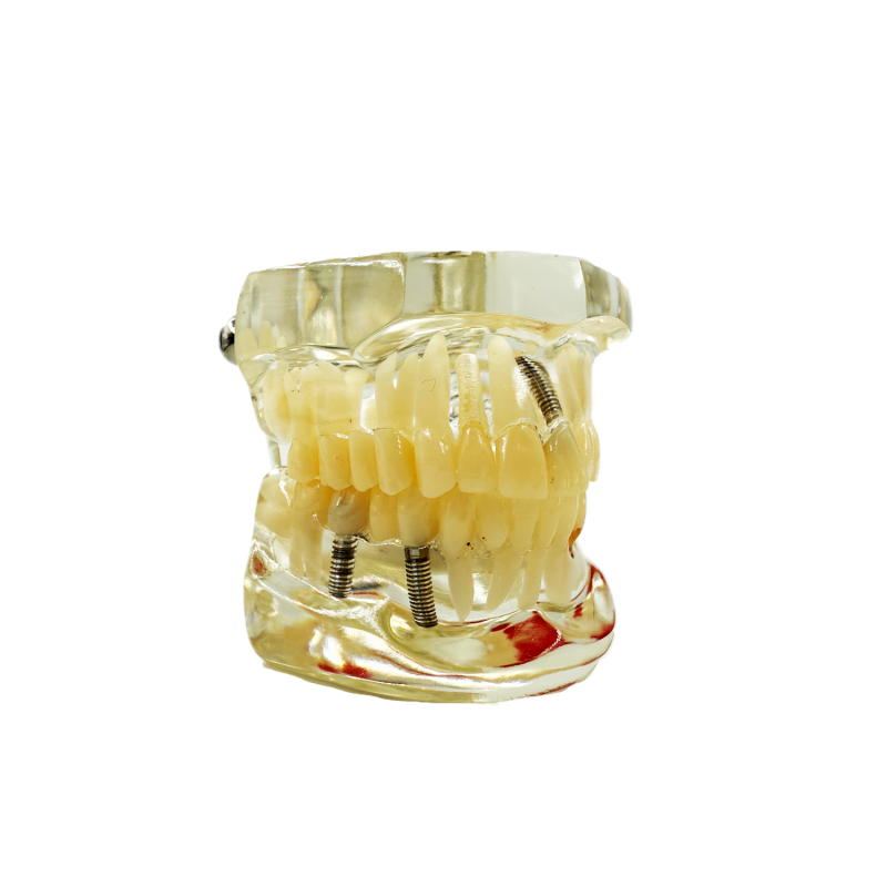 Model studiu 8 patologii dentare