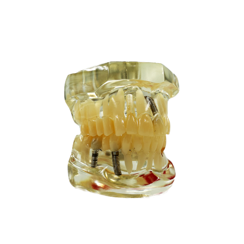 Model studiu 8 patologii dentare