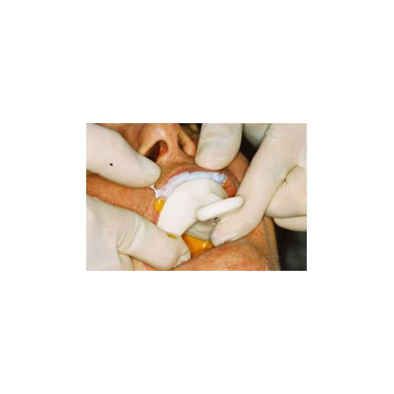 Material de amprenta Affinis Monobody