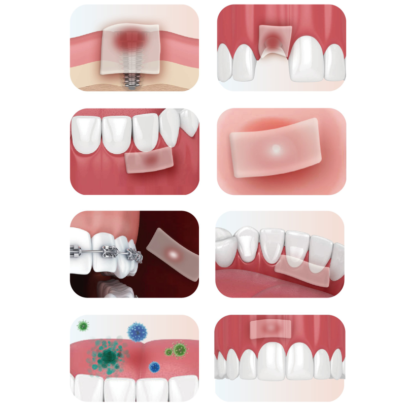 Pansament intraoral Bona-Aid 20 buc