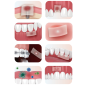 Pansament intraoral Bona-Aid 20 buc Pansament intraoral Bona-Aid 20 buc