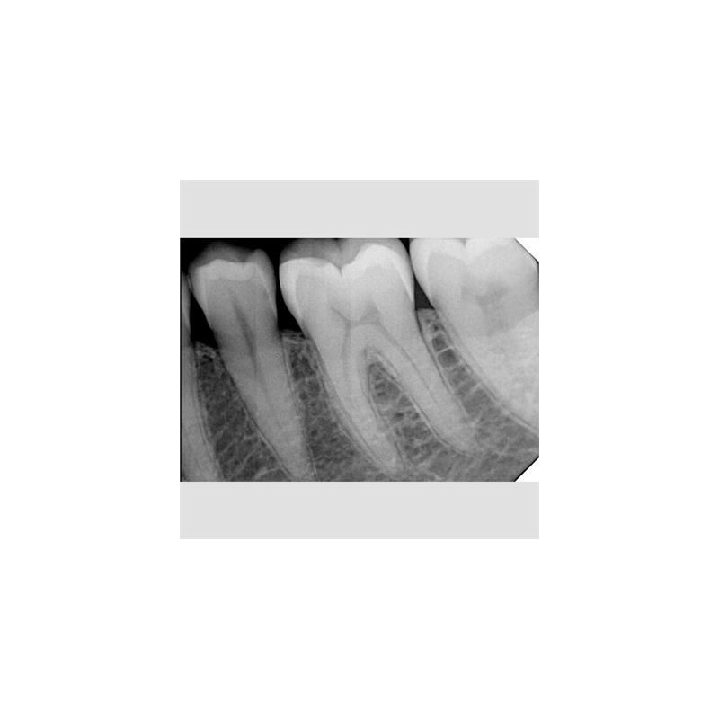 Senzor RVG StarX Pro marimea 1