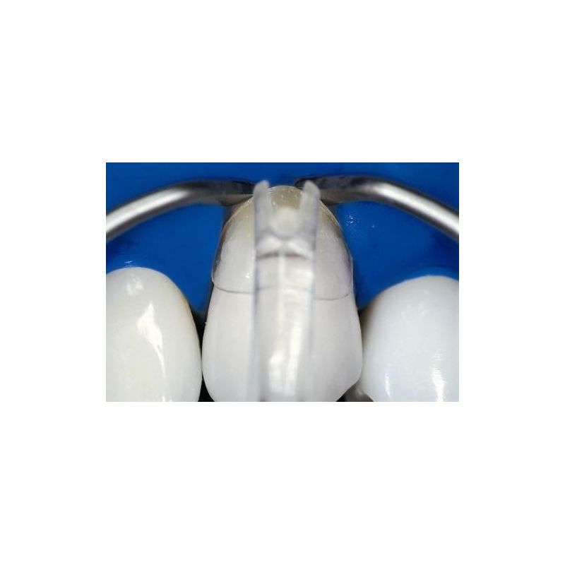 Matrici cervicale transparente