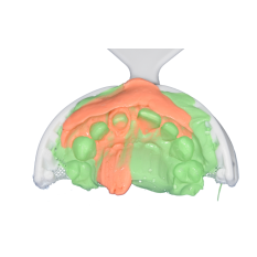 Material de amprenta astringent NoCord