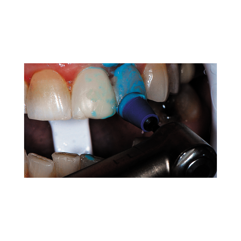 Pasta finisare diamantata Couture